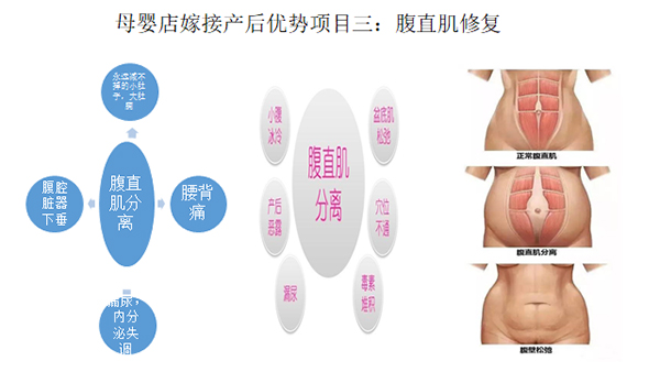 少林永化堂產(chǎn)后項目-腹直肌修復(fù)