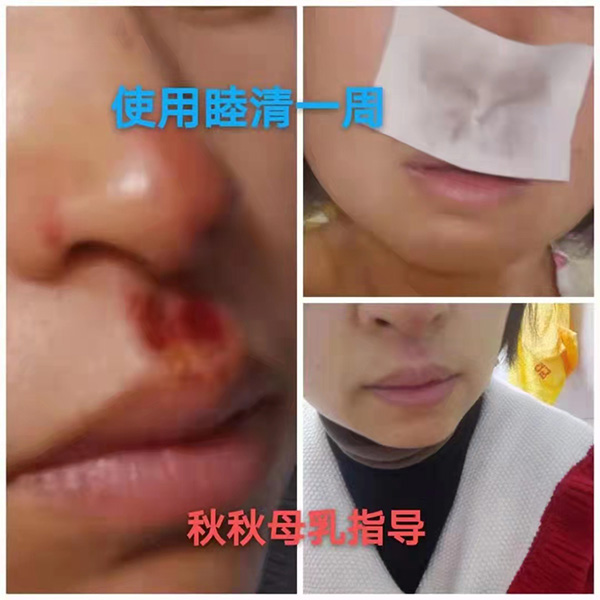 �����澏���N���Æ᣿���M(f��i)�߿ڱ���������(sh��)���a(ch��n)ƷȦ�۟o(w��)��(sh��)