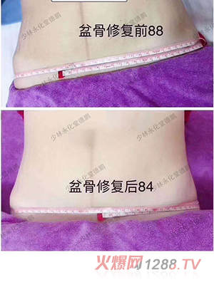 ���������îa(ch��n)���Ŀ-�����ޏ�(f��)